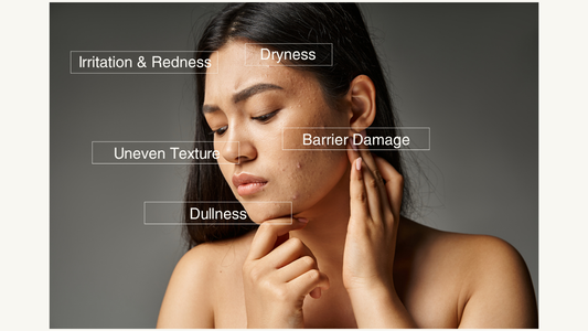 Skin reddness, acne, iirirtation, skin barrier weak